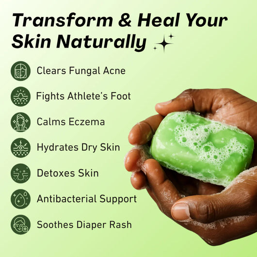 Shaney® AntiFungal Relief Soap Bar