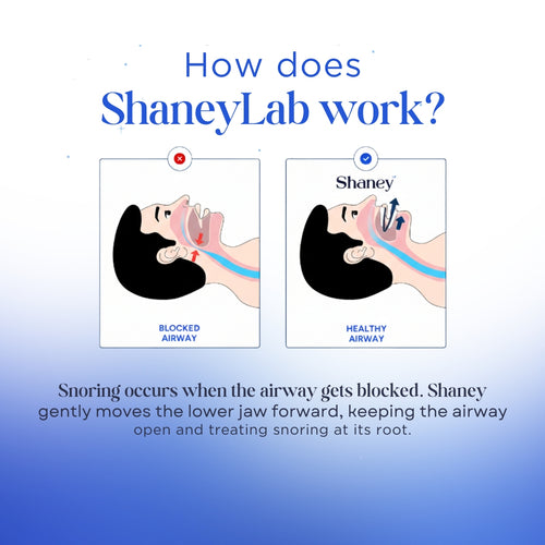 Shaney® - Adjustable  Anti-Snoring Mouthpiece